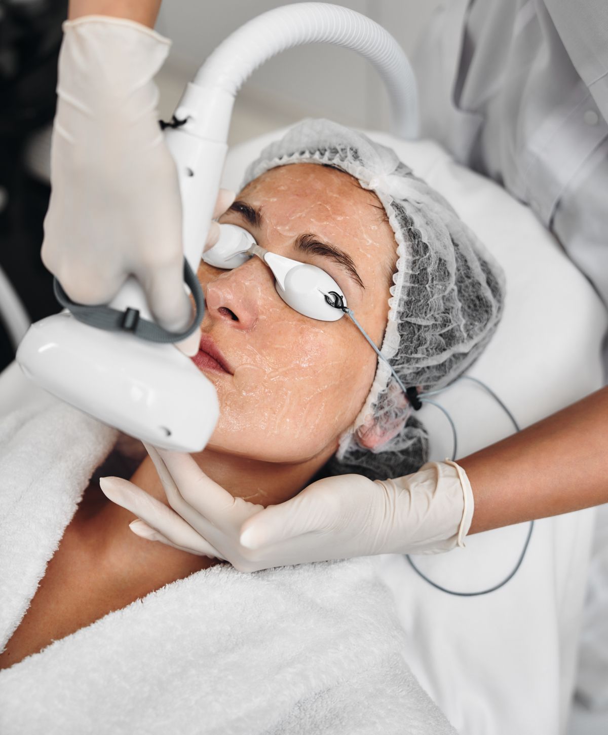 Woman undergoing laser treatment for skin care.