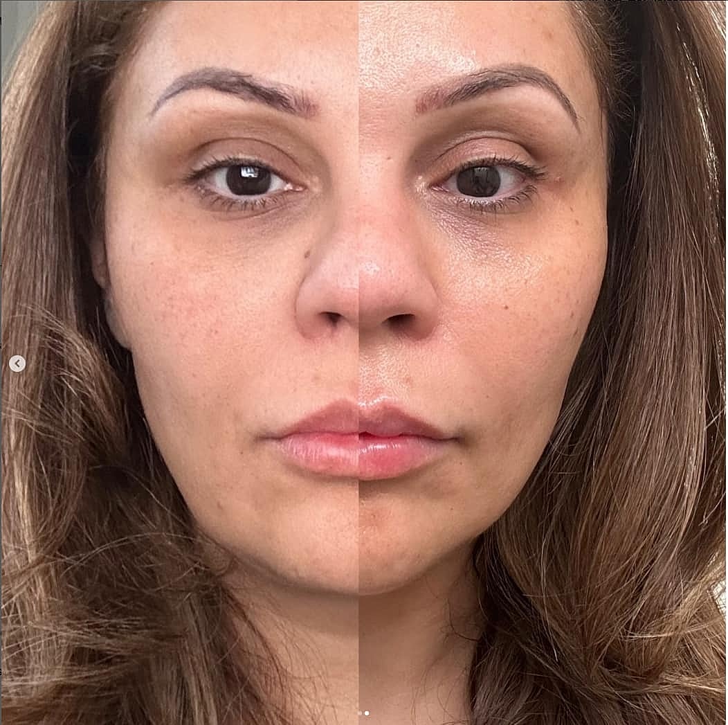 Plexr Before & After