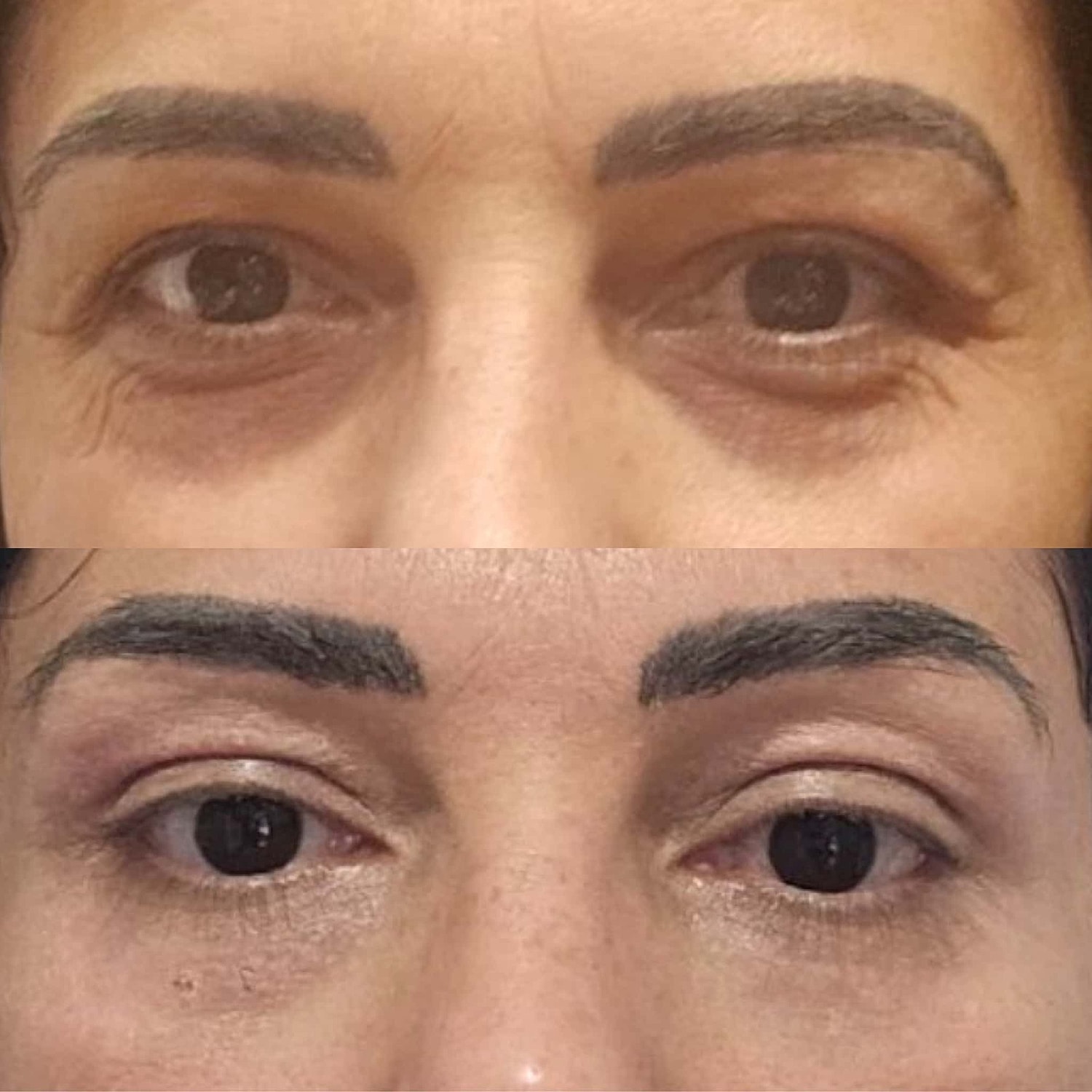 Plexr Before & After