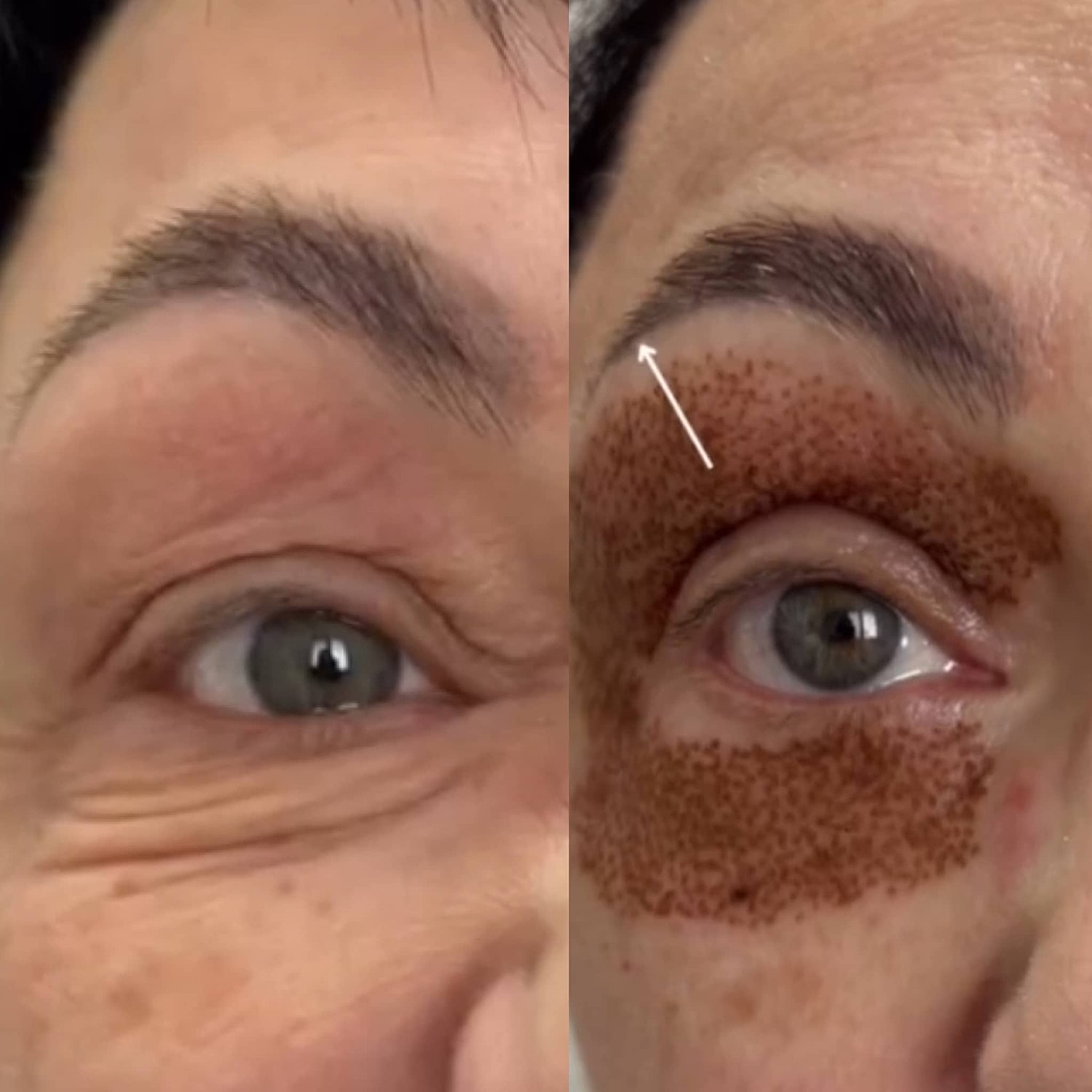 Plexr Before & After