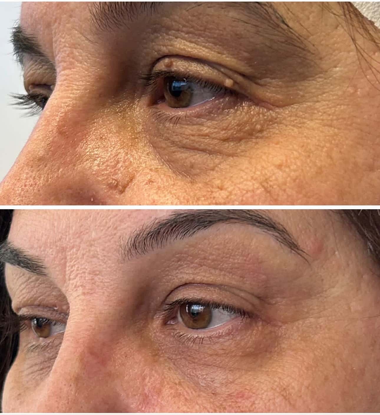 Plexr Before & After