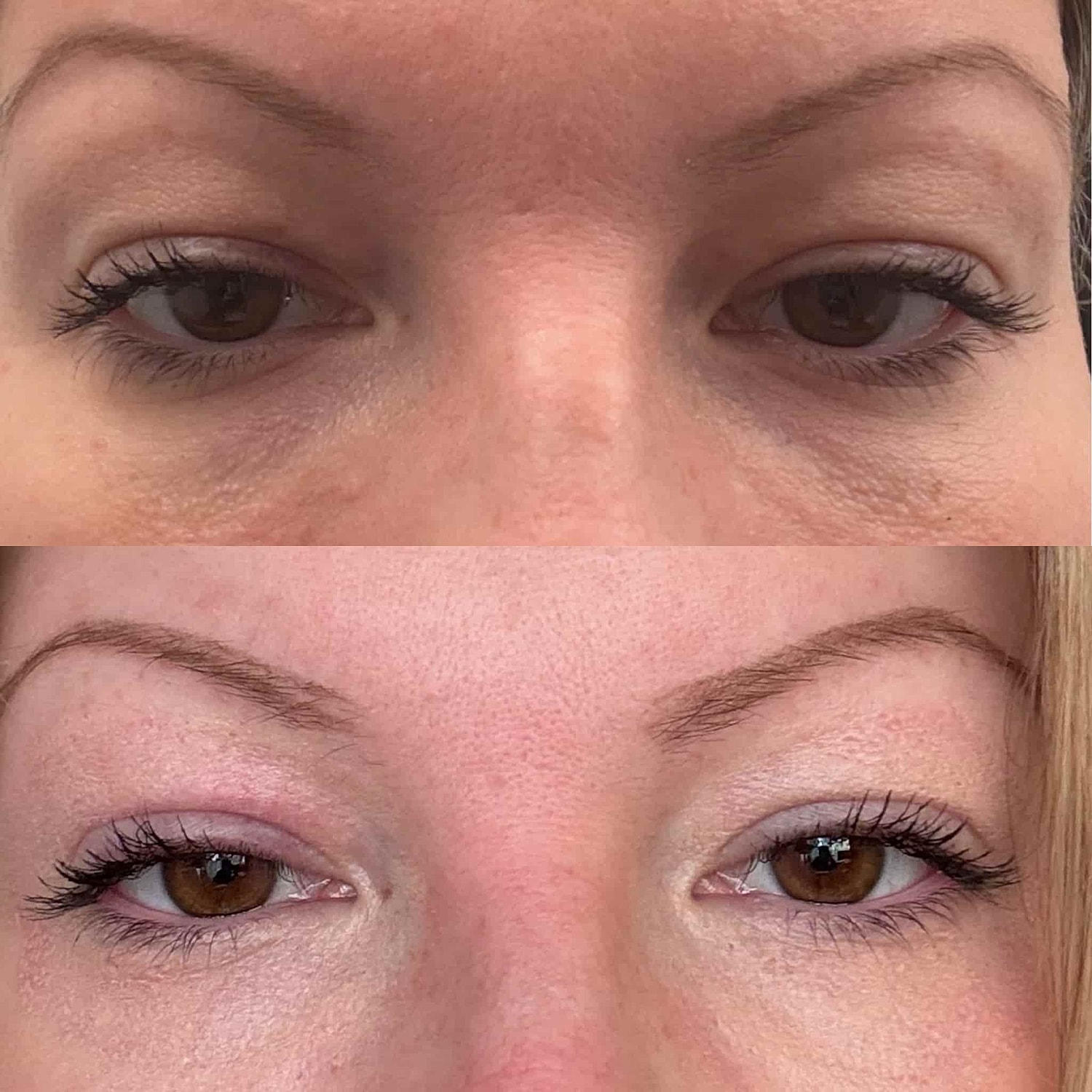 Plexr Before & After