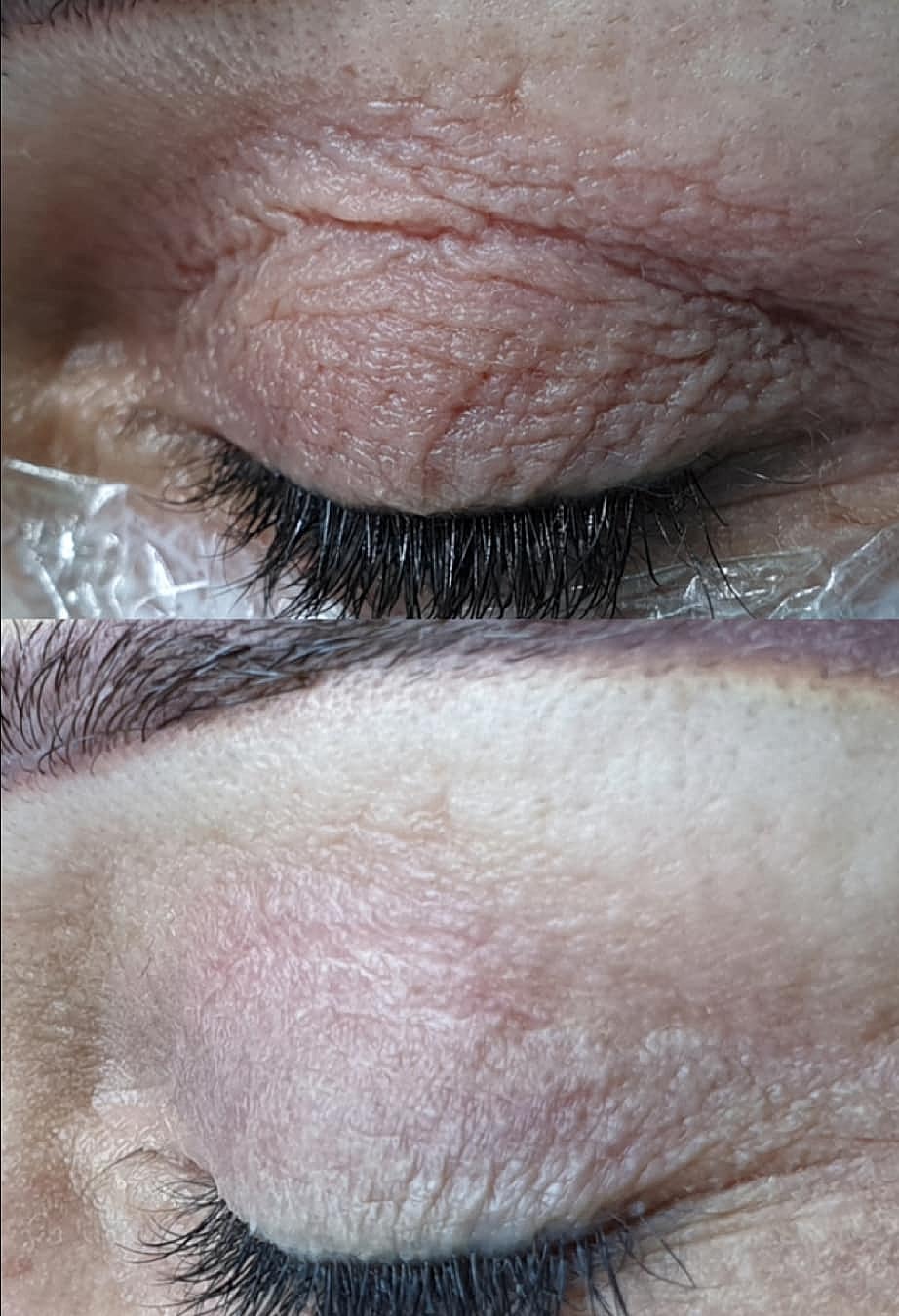 Plexr Before & After