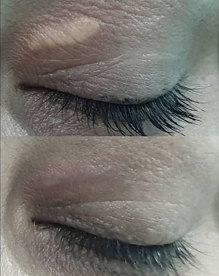 Plexr Before & After