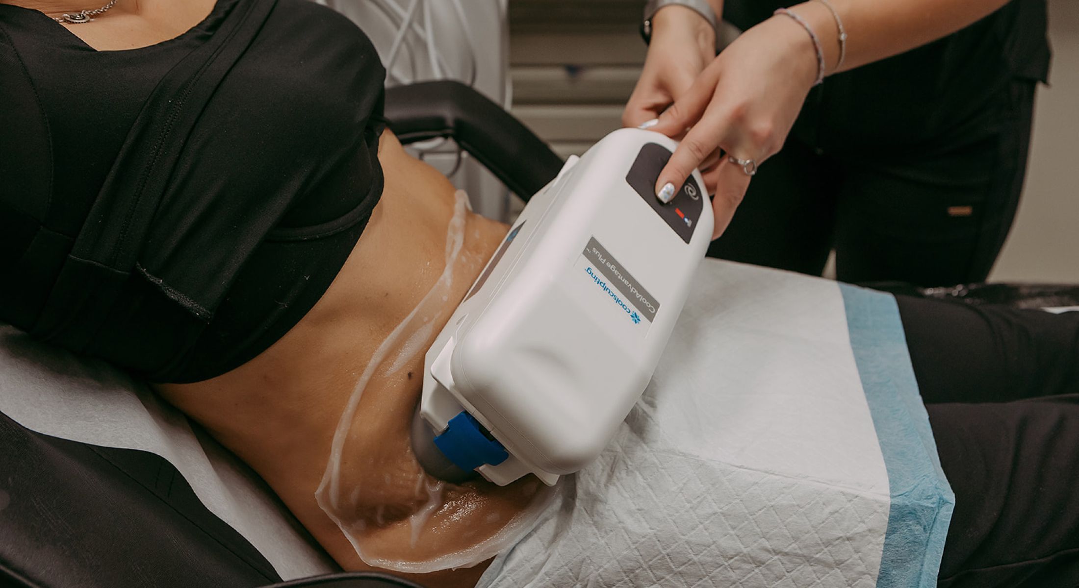 CoolSculpting treatment on a patient's abdomen.